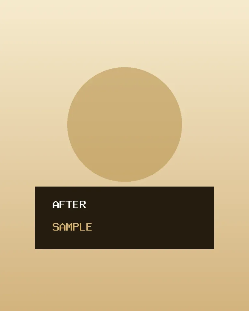 Porcelain Veneers after treatment — sample placeholder, not a real patient